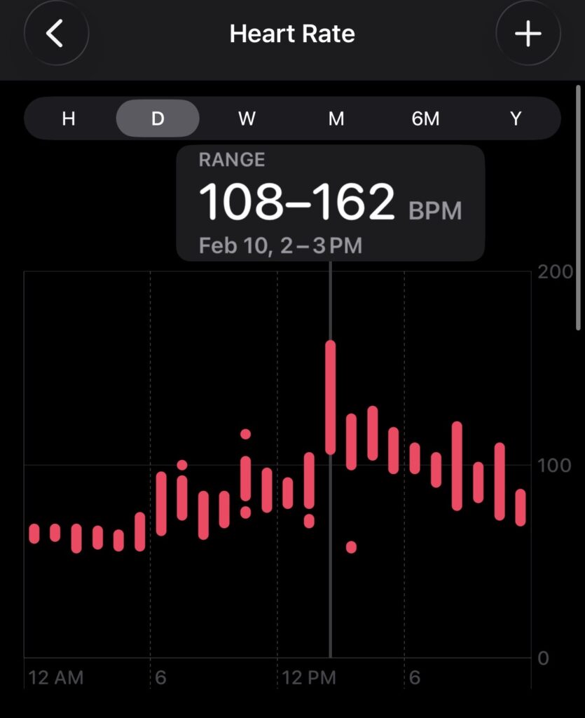 My heart rate as seen in Apple Health during the hour that my defibrillator shocked me and when the ambulance came to pick me up. As it turns out, this is when the device started double counting and shocking me multiple times.